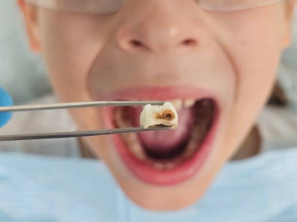 Best Orthodontic Emergency Dentist in Glen Rose, TX