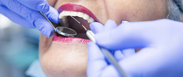 Best Emergency Root Canal Treatment in Glen Rose, TX